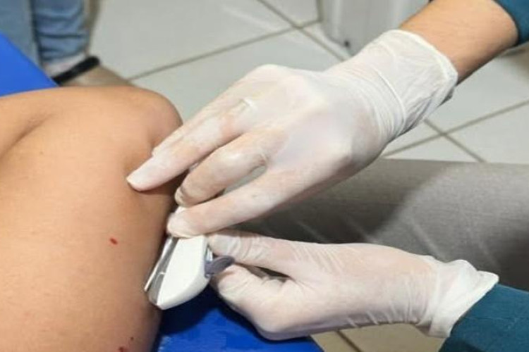 Prefeitura de Mineiros oferece Implanon e amplia cuidado com a saúde da mulher